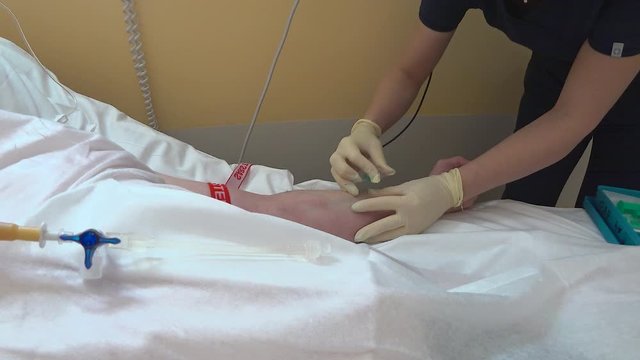 An unidentified masked nurse inserts a catheter into the patient's vein. Details of the operation to stage a venous catheter.