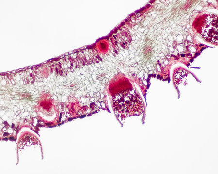 Parasitic plant fungus Puccinia microscope slide.