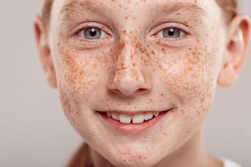 Inclusive Beauty. Girl with freckles standing isolated on grey smiling cheerful close-up