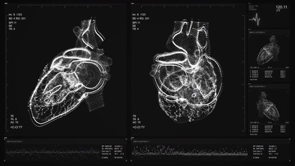 Heart scan screen animation. Blood pressure and heart rate are displayed on a modern and high-tech screen. Health data measuring. Diagnosis of diseases. Futuristic MRI process video. 4K X-ray Concept - Powered by Adobe