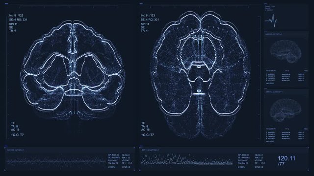 Brain scan screen animation. Device scans and displays patient vital signs. Neurology data. Diagnosis of diseases. Radiology research or examination process. Futuristic MRI video concept. 4K footage
