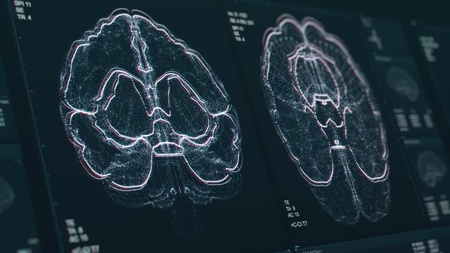 Brain scan screen animation. The device scans and displays vital signs. Neurology data. Diagnosis of diseases. The future of MRI video. 4K footage with Depth of Field effect