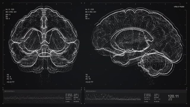 Brain scan screen animation. The device scans and displays vital signs. Neurology data. Diagnosis of diseases. The future of MRI video. 4K footage