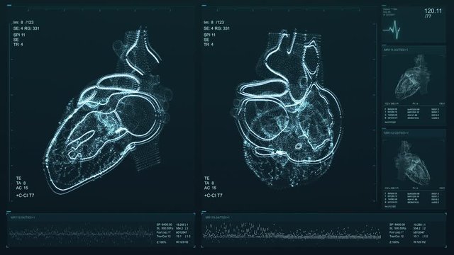 Heart scan screen animation. Blood pressure and heart rate are displayed on a modern and high-tech screen. Health data. Diagnosis of diseases. The future of MRI video. 4K Quality footage 