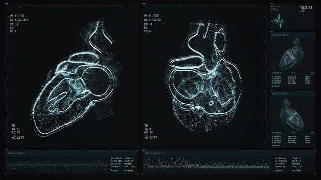 Heart scan screen animation. Blood pressure and heart rate are displayed on a modern and high-tech screen. Health data. Diagnosis of diseases. The future of MRI video. 4K Quality footage 