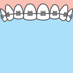 Blank banner metal braces (upper) teeth illustration vector on blue background. Dental concept.