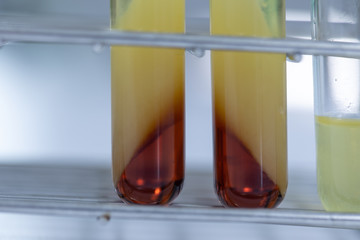 Biodiesel production is the process of producing the biofuel, biodiesel, in laboratory.