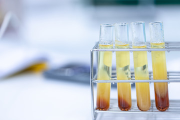 Biodiesel production is the process of producing the biofuel, biodiesel, in laboratory.