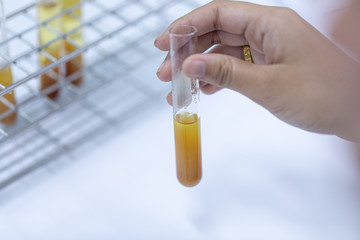 Biodiesel production is the process of producing the biofuel, biodiesel, in laboratory.