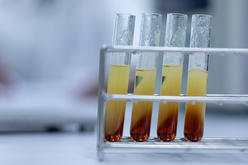 Biodiesel production is the process of producing the biofuel, biodiesel, in laboratory.