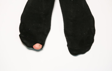 Ripped socks on man's feet. Shabby clothes. Poor person.