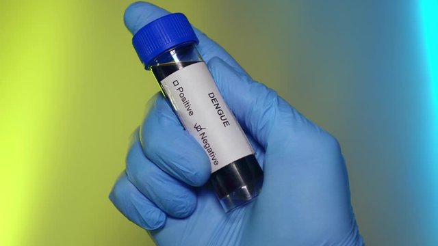 Negative Blood Test Tube Dengue Fever Virus Infection Outbreak Epidemic