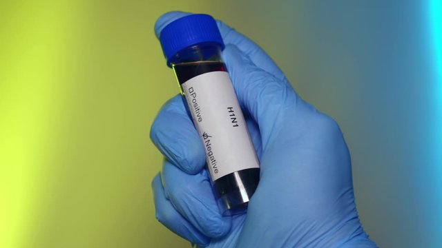 Negative Blood Test Tube H1N1 Virus Infection Outbreak Epidemic