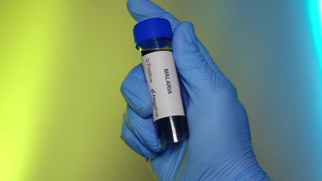 Negative Blood Test Tube Malaria Virus Infection Outbreak Epidemic