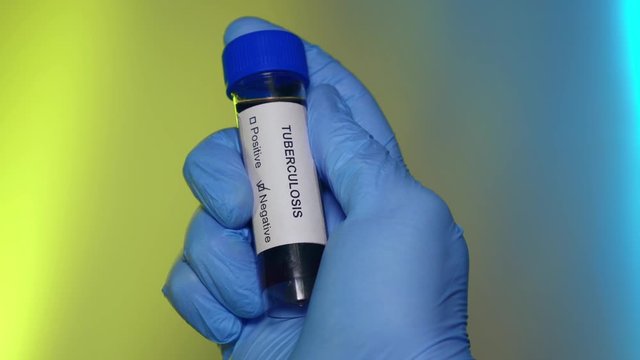 Negative Blood Test Tube Tuberculosis Virus Infection Outbreak Epidemic