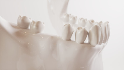 Tooth implantation picture series V02 - 1 of 8 - 3D Rendering