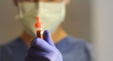 close up of a blood sample held by a laboratory doctor in the background