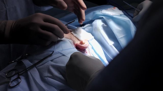 Otoplasty surgery close-up, correction of protruding ears., the begining of operation