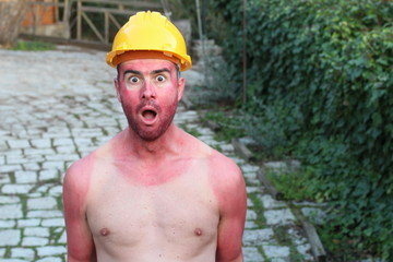 Sunburned construction worker with extreme tan lines 