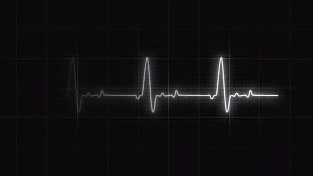 Glowing Monochrome heart rate or heart beat line. Cardiogram signal monitoring process. Isolated on black. Patient&rsquo;s vital signs. Medical and science 4K footage. Cardiology indicator. Electocardiogram