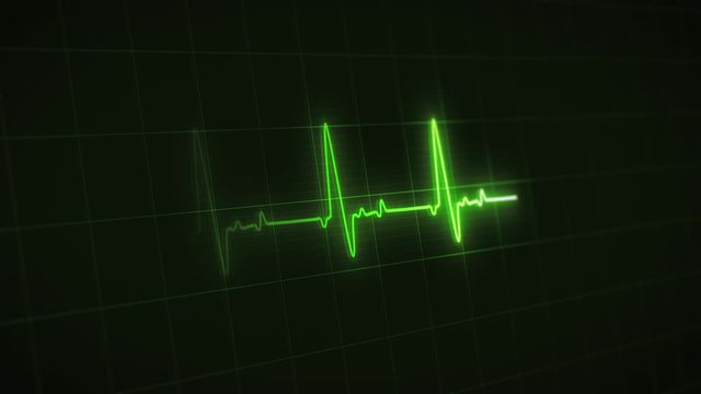 Green colored heart rate or heart beat line. Cardiogram signal monitoring process. Isolated on black. Patient's vital signs. EKG, ECG curve. Pulse measuring. Medical footage. Cardiological video in 4K