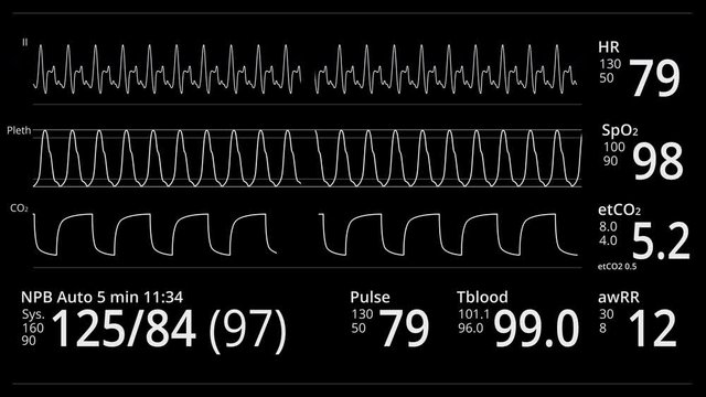 Monitoring patient Vital signs. Heart rate or heart beat, oxygen saturation, respiration indication. ICU monitor or display in hospital. Medical and science clip. Cardiogram footage. EKG, ECG screen.