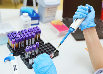 scientist in a medical laboratory with a dispenser in his hands is doing an analysis