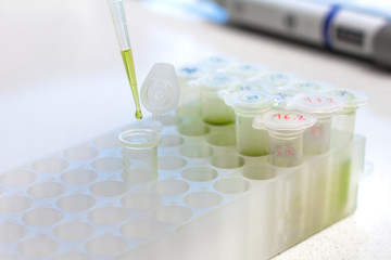 Clinical laboratory in process of chemical analysis. Collection of probe using automatic pipette.