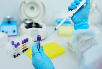 Fototapeta premium A scientist in a medical laboratory with a dispenser in his hands is doing an analysis
