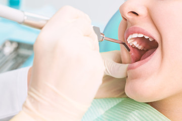 Girl sitting at dental chair with open mouth during oral check up while doctor. Visiting dentist office. Dentistry concept.