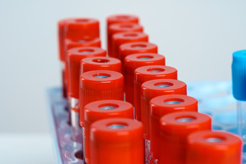 Blood sample tubes  medical equipment close up