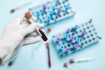 Person with the medical glove handling a blood vial