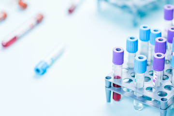 Tube vials with blood sample and medical samples in rake, medical analysis laboratory
