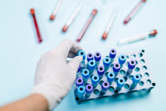 Doctor In The Analytical Laboratory Who Picks Up A Vial From The Rack With Medical Evidence