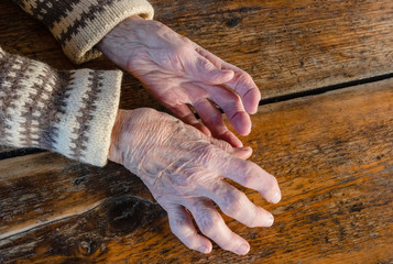 Old women, sickly hands on a wooden table. Rheumatoid arthritis, osteoarthritis. Medicine. Chronic disease. 
