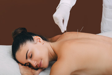 Woman enjoys the acupuncture procedure. An acupuncturist doing acupuncture very accurately. Needle...