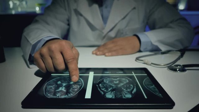 doctor working at his desk at night checking x-rays on tablet computer close up on hands