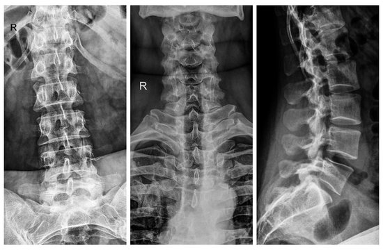 x-ray film of human spine