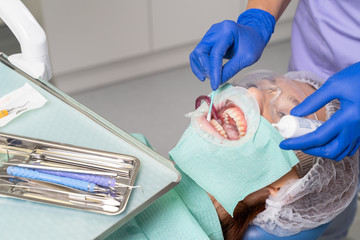 The dentist uses a cotton swab to apply the medicine to the patient’s gums, in order to heal the...