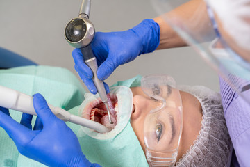 A close-up of the patient’s girl at the moment when the dentist treats oral caries with specialized tools.
