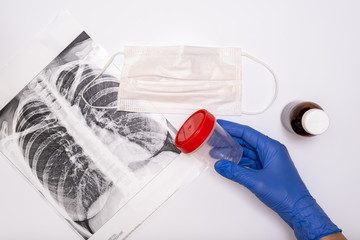 A doctor in medical gloves holding an analysis container, an x-ray of lungs, face mask and medicine...