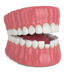 3d render of opened jaw with broken incisor lower tooth