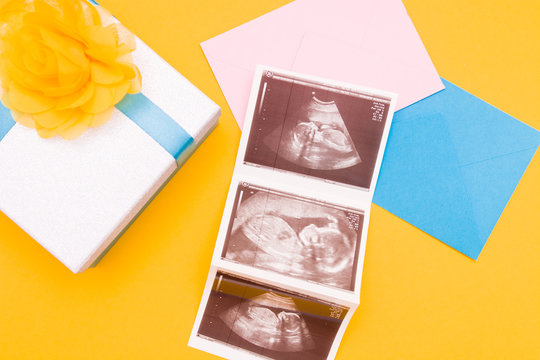pic of ultrasound on pink and blue envelopes, next to which is a silver box with a blue ribbon and a yellow flower made of fabric, yellow background copy space top view, boy or girl, pregnancy concept