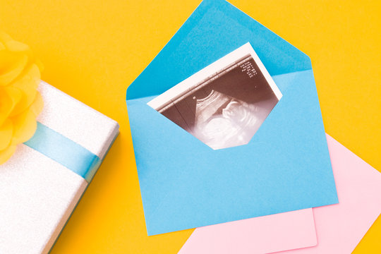 a picture of an ultrasound in a blue envelope, box with a ribbon and a yellow flower and a pink envelope made of fabric, yellow background copy space top view, woman pregnant  boy or girl