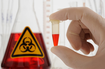 coronavirus in laboratory test
