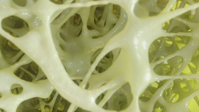 Bone affected with osteoporosis - cross section - 3D rendering