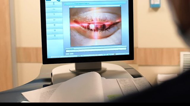 Laser vision correction. A patient and a surgeon in the operating room during ophthalmic surgery. Opened eye. Patient under sterile cover. Closeup