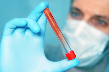 Doctor in a respirator mask and medical gloves holds in his hands a test tube with blood tests....
