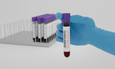 Test tubes with blood and coronavirus test label  isolated on white background. Concept for testing...