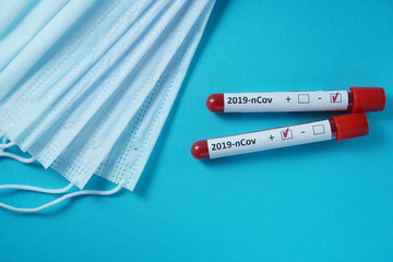 Blood test result for the new rapidly spreading Coronavirus, originating in Wuhan, China. 2019-nCoV     